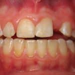 after initial ortho (4) after initial ortho (4)