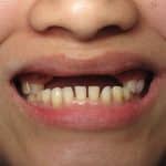 IMG_7992 IMG_7992