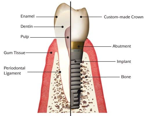 ceramic-biomaterials-by-jon-velez-openwetware