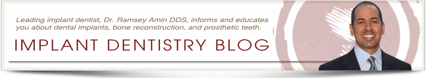 burbank dental implants