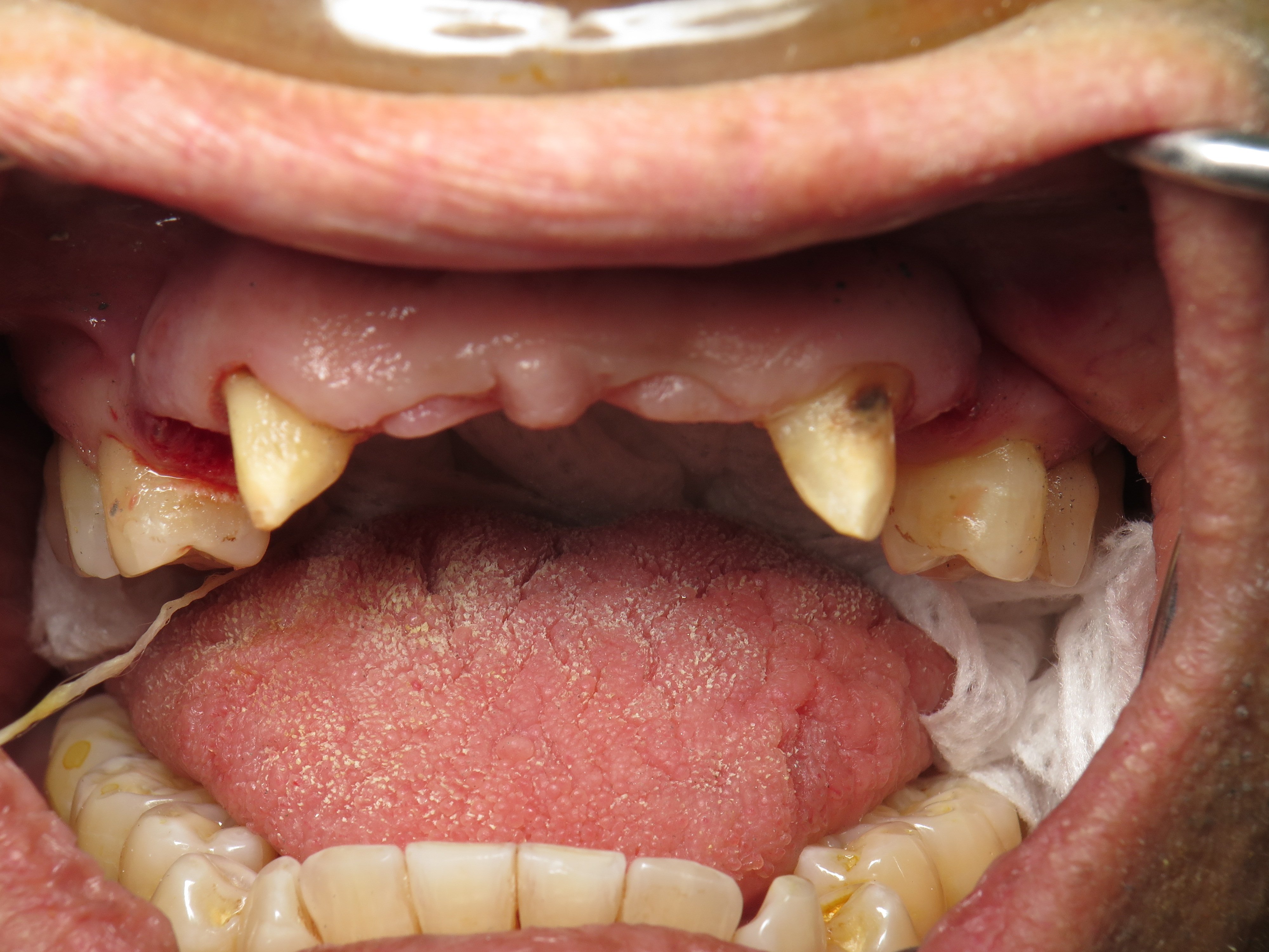 Flipper/Stayplate/Bridge Temporary Implant Bone Graft Facts Ramsey A