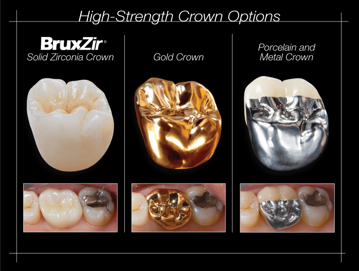 ramsey amin dds reviews solid zirconia custom dental implant crowns zirconia crowns