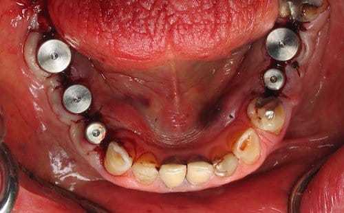 How To Make A Dog S Gums Stop Bleeding How To Make A Dog S Gums Stop Bleeding